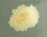mycobacterium mycobacterium